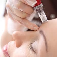 Discover the Ultimate Microneedling Experience at House of Aesthetix